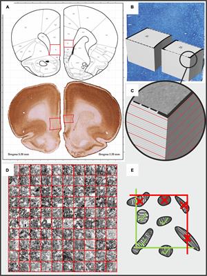 A Preliminary Quantitative Electron Microscopic Analysis Reveals Reduced Number of Mitochondria in the Infralimbic Cortex of Rats Exposed to Chronic Mild Stress